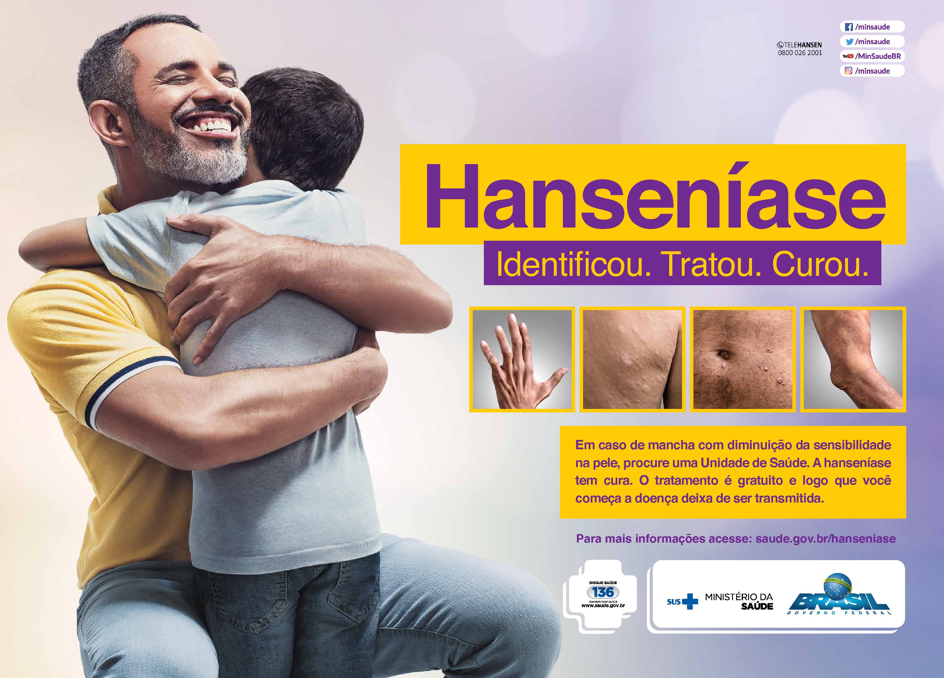 Ministério da Saúde 🩵 on X: Pacientes com hanseníase passam a